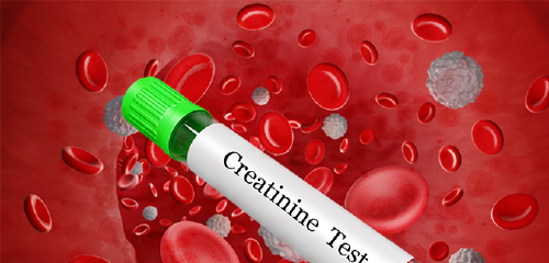 Featured Image for Creatinine Clearance Calculator