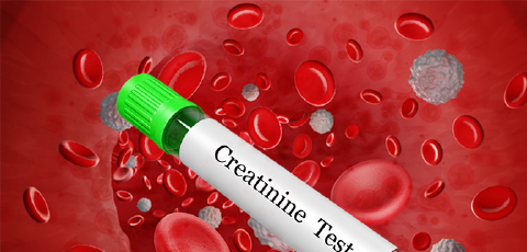 Featured Image for Creatinine Clearance Calculator